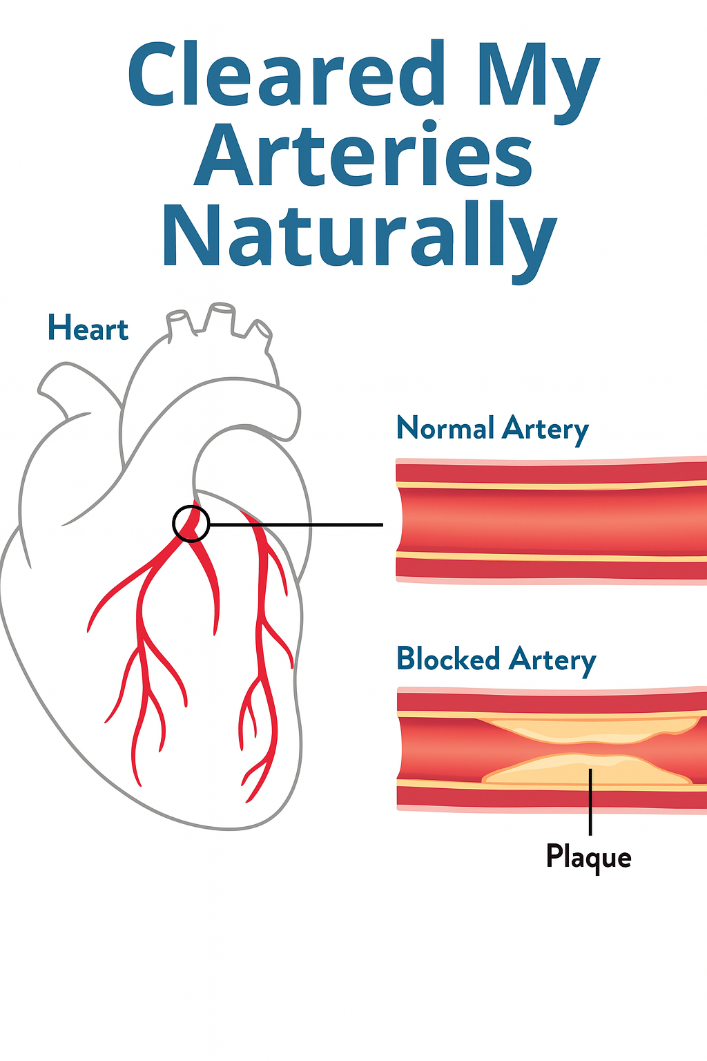 8. Naturally cleared my arteries